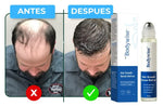 Bodywise Sérum Crecimiento Capilar